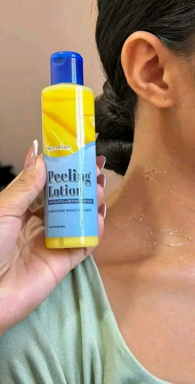 SkeenCare Face & Body Peeling Lotion – Kojic Acid & Aloe Vera